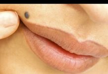 VIDEO: अगर इन 10 जगहों पर है तिल तो नहीं होगी पैसों की कमी…