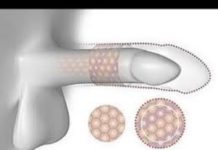 लिंग की समस्याओं से सिर्फ 2 दिन में पाए निजाद