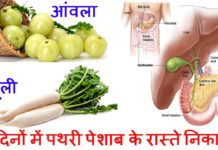 मात्र 7 दिन में पथरी पेशाब के रास्ते से निकले, जानिए घरेलु तरीका