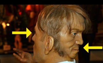 HOT NEWS UPDATE : क्या दुनिया में दो मुँह वाले भी व्यक्ति होते है || देखिए इस दो मुँह वाले व्यक्ति को