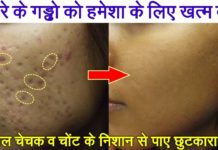 HOT NEWS UPDATE : ये नुस्खे आजमाने से आपके चेहरे के दाग, धब्बे व गड्ढे चले जायेगे || जानने के लिए देखिये ये वीडियो