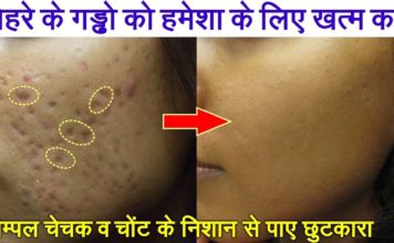 HOT NEWS UPDATE : ये नुस्खे आजमाने से आपके चेहरे के दाग, धब्बे व गड्ढे चले जायेगे || जानने के लिए देखिये ये वीडियो
