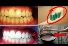 सिर्फ 2 मिनट में पीले गंदे दाँतों को मोती जैसा चमका देगा ये ज़बरदस्त घरेलु नुस्खा