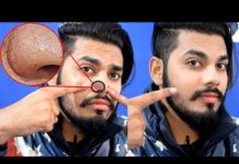 HOT NEWS UPDATE : घर बैठे ब्लैक हेड्स कैसे दूर करे || जानने के लिए देखिये ये वीडियो