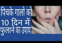 VIDEO : क्या आप अपने चिपके हुए गालो से परेशान है तो जरूर देखिये यह वीडियो