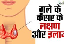 यह हैं गले के कैंसर के लक्षण और इसे भूलकर भी न करें इसे नज़रअंदाज़