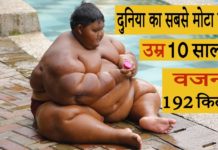 दुनिया का सबसे मोटा बच्चा , उम्र 10 साल , वजन 192 किलो