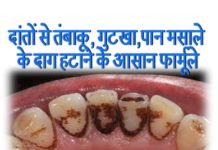 दातों से गुटखा और पानमसालो के दाग से इस तरह पाए निजात