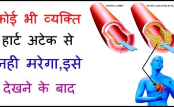भविष्य में हार्ट अटैक से बचना चाहते हैं तो यह वीडियो जरूर देख लें