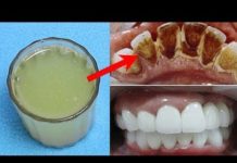 2 मिनिट में पीले दातों को चमका देगा यह नुस्खा || Teeth Whitening at Home