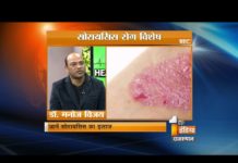 सोरायसिस क्या है? || What is psoriasis?