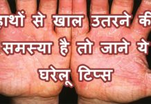 हाथों से खाल उतरने की समस्या है तो जाने ये घरेलू टिप्स || Skin peeling problem