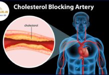 कोलेस्ट्रोल क्या है? | What Is Cholesterol in Hindi
