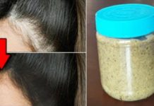 बालों को दोबारा उगाये व इन्हे इस तरह रोके झड़ने से | Best Hair Solution at Home