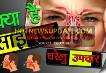 साइनस क्या होता हैं / लक्षण / इलाज | Home Remedy for Sinus