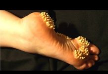 दुनिया की सबसे दुर्लभ और विचित्र बीमारिया || Rare & Strange Diseases in the World