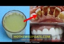 दातों को सफ़ेद करने का घरेलु नुस्खे | दाँतों का पीलापन | Teeth Whitening at Home