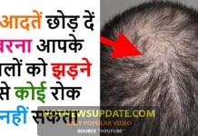 बाल झड़ने के कारण | balon kai jhadne ke karan