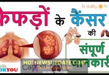 Lung( फेफड़ो) का कैंसर क्या हैं| जाने लक्षण और कारण | Lung Cancer In Hindi