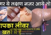 यह 10 लक्षण नजर आएं तो तुरंत अपने लीवर की जांच करवाएं | Liver Test