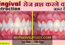 दांतों और मसूड़ों को मजबूत करने के आसान नुस्खे।